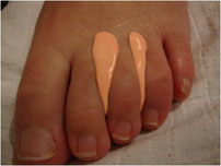 Orthesiologie